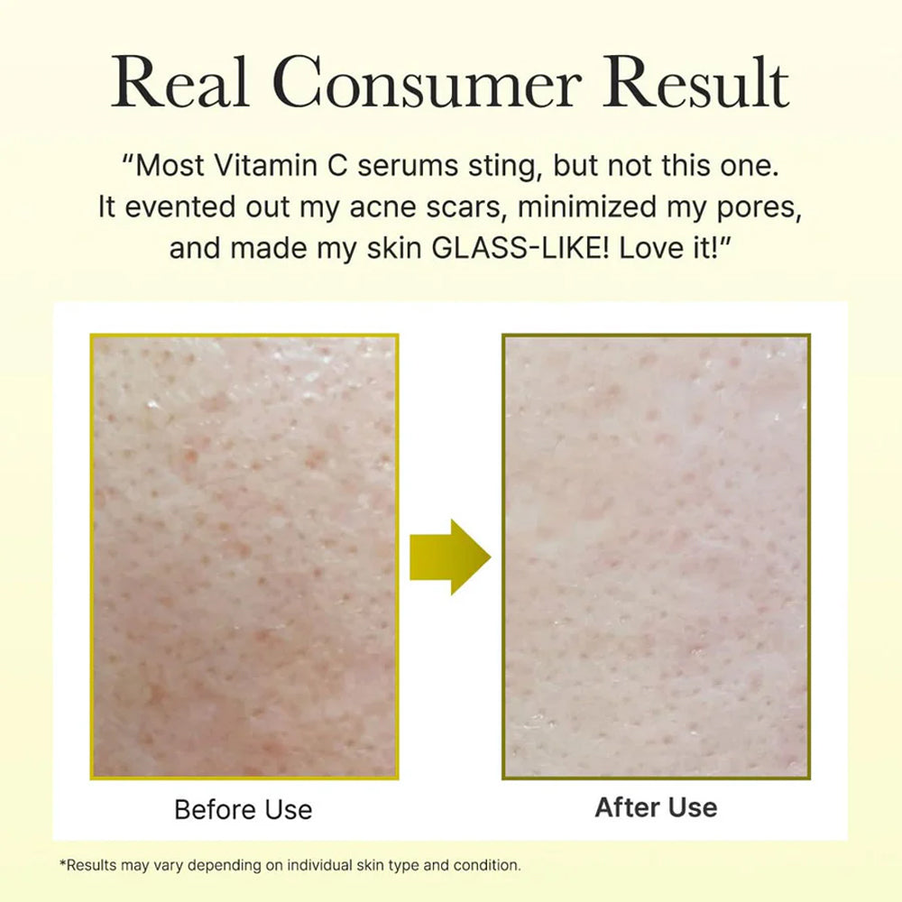 Arencia Vitamin C Booster Shot Serum (30ml)