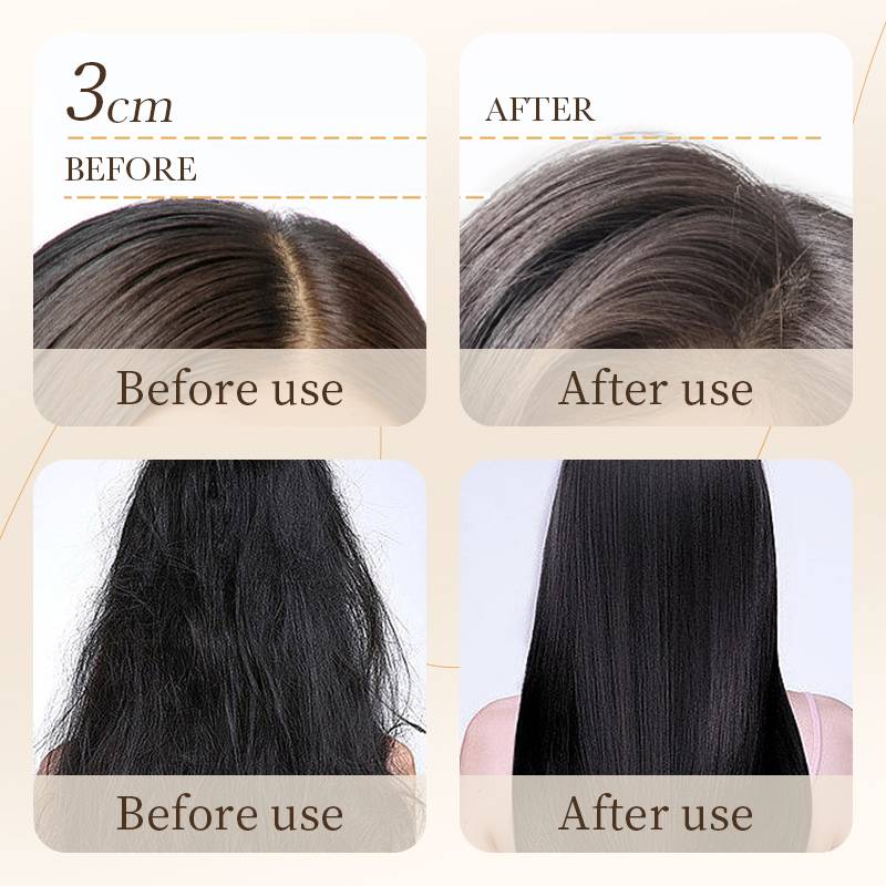 BIOAQUA Rice Shampoo - Anti-Dandruff & Oil Control Shampoo - 500ml