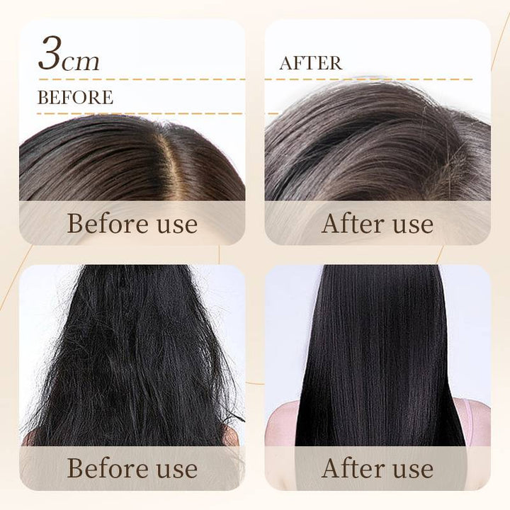 BIOAQUA Rice Shampoo - Anti-Dandruff & Oil Control Shampoo - 500ml