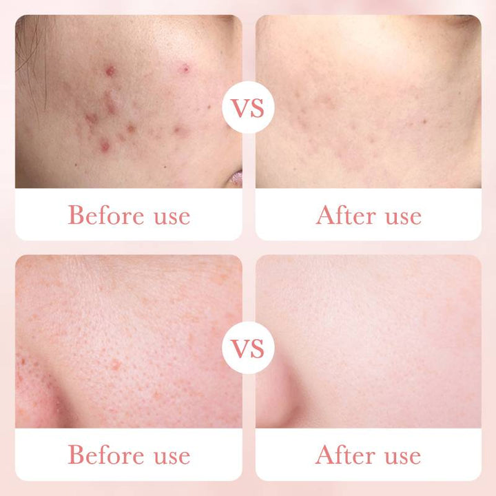 Bioaqua Rose Hyaluronic Acid Moisturizing Face Cream 50g