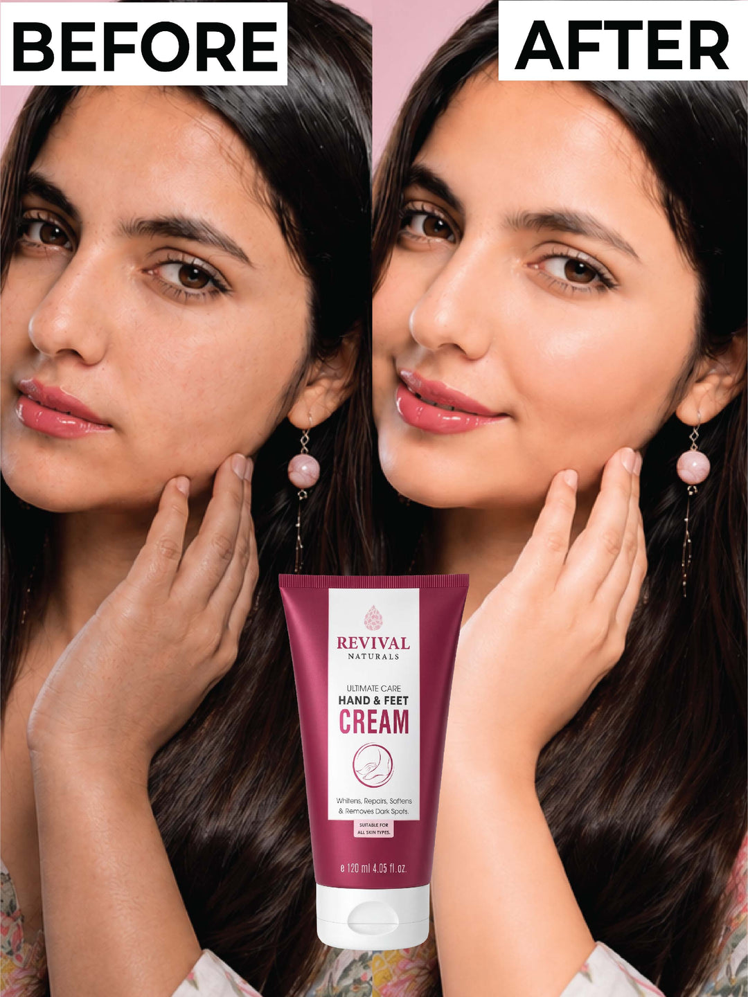 Ultimate Care Cream (Hand & Feet)