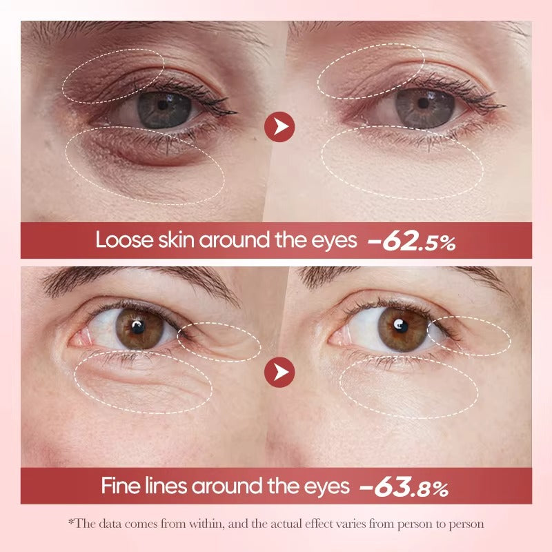 Bioaqua Nicotinamide Eye Cream – 20g | Dark Circles & Fine Line Care