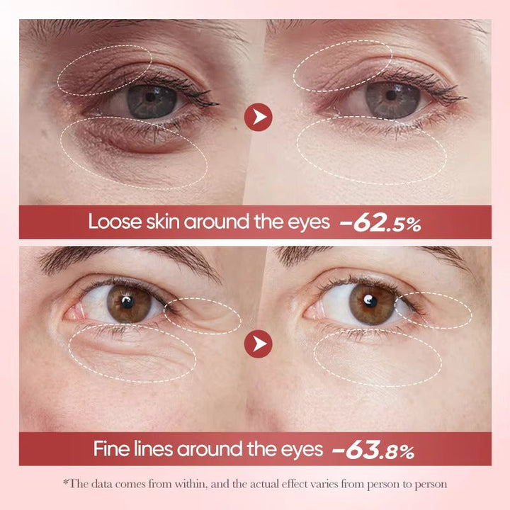 Bioaqua Nicotinamide Eye Cream – 20g | Dark Circles & Fine Line Care